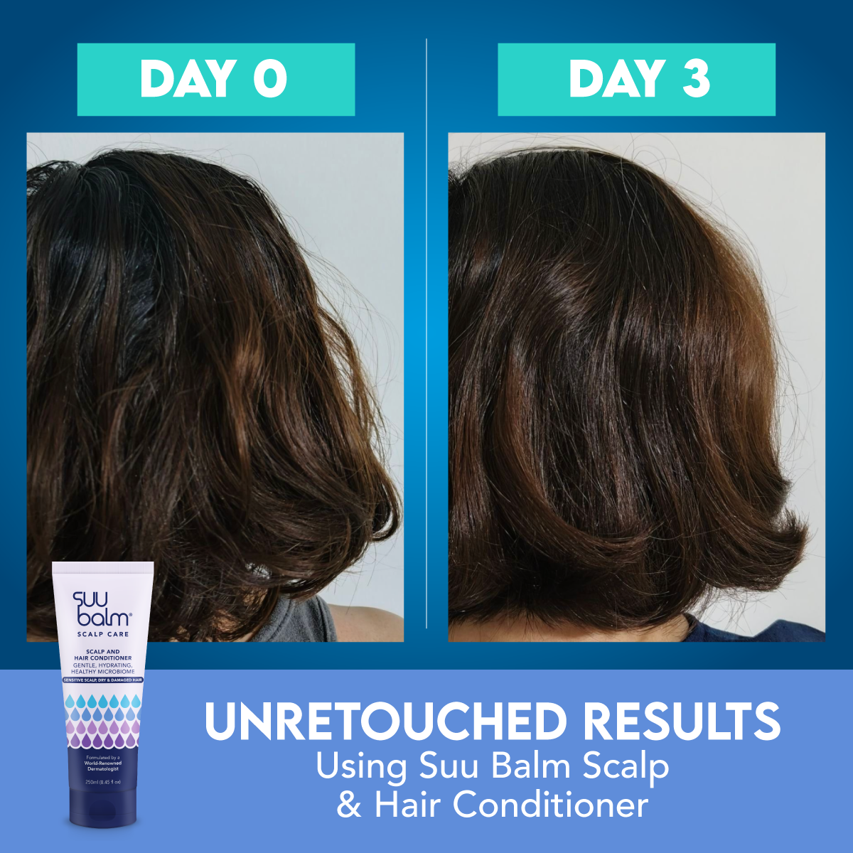 Suu Balm Scalp Care Scalp and Hair Conditioner 250mL Gentle, Hydrating, Healthy Microbiome