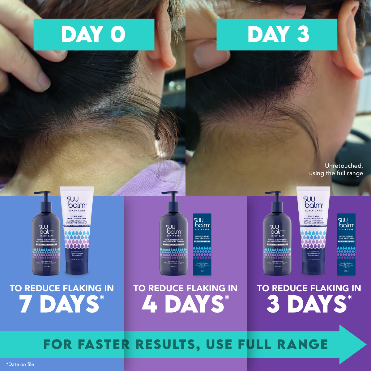 Suu Balm Scalp Care Scalp and Hair Conditioner 250mL Gentle, Hydrating, Healthy Microbiome